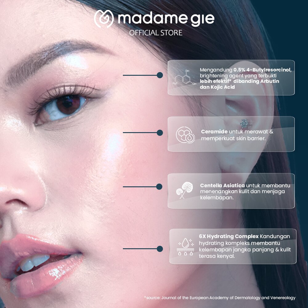 Madame Gie - Resocera